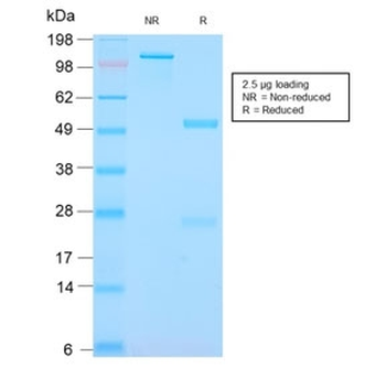 S100A9 + Calprotectin Antibody