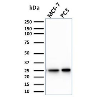 CHP2 Antibody / Calcineurin B homologous protein 2