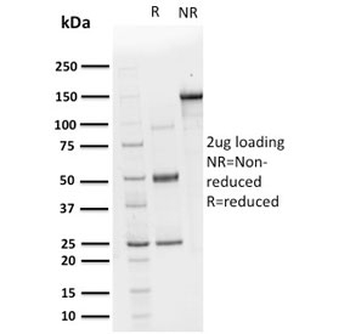 CHP2 Antibody / Calcineurin B homologous protein 2