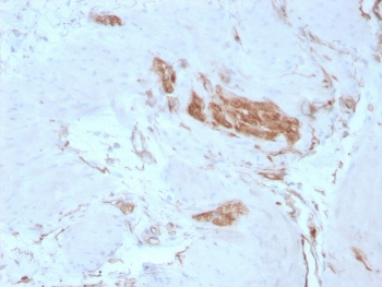 SPTAN1 Antibody / Alpha II Spectrin / Alpha Fodrin / NEAS