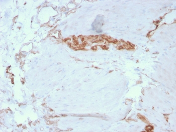 SPTAN1 Antibody / Alpha II Spectrin / Alpha Fodrin / NEAS