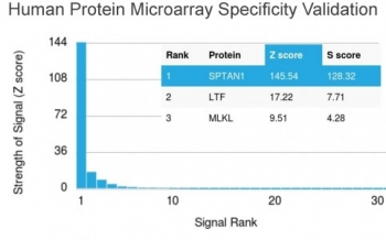 SPTAN1 Antibody / Alpha II Spectrin / Alpha Fodrin / NEAS