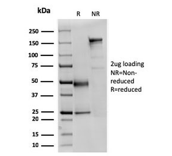 SPTAN1 Antibody / Alpha II Spectrin / Alpha Fodrin / NEAS