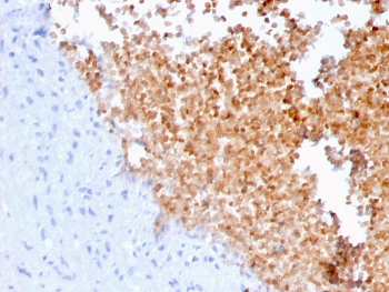 Alpha II Spectrin Antibody / Alpha Fodrin / SPTAN1 / NEAS