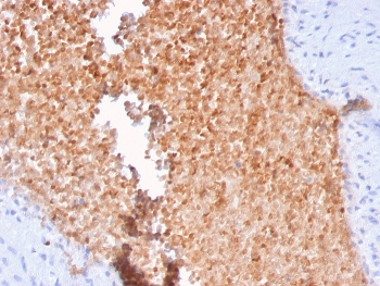 Alpha II Spectrin Antibody / Alpha Fodrin / SPTAN1 / NEAS