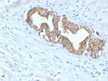 AMACR / p504S Antibody (Prostate Cancer Marker)