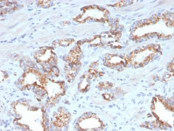 AMACR / p504S Antibody (Prostate Cancer Marker)