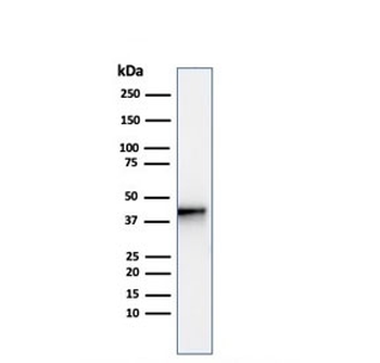 AMACR / p504S Antibody (Prostate Cancer Marker)