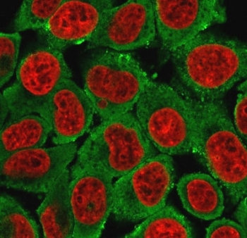 Cytokeratin 15 Antibody / KRT15