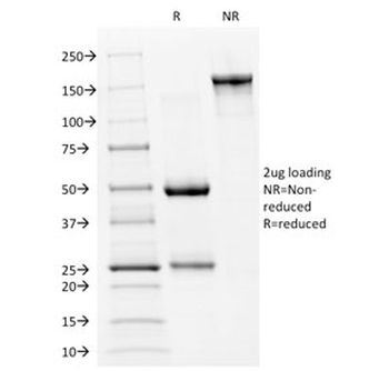 p53 Antibody / TP53