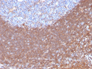 Calpastatin Antibody