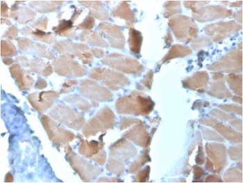 Actinin Alpha 2 Antibody / Sarcomeric Alpha Actinin / ACTN2