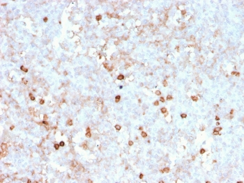 CD14 Antibody