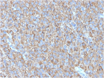 CD63 Antibody / LAMP-3