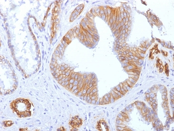 E-Cadherin Antibody / CDH1