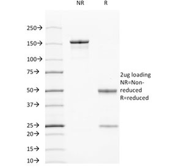 Cytokeratin 7/17 Antibody