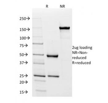 Pan-HLA Antibody (MHC II)