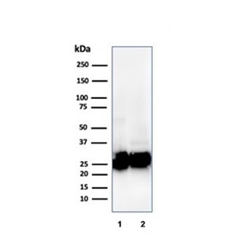 Pan-HLA Antibody (MHC II)