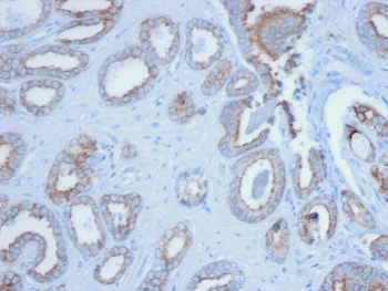 Pan Cytokeratin Antibody Cocktail (Acidic + Basic)