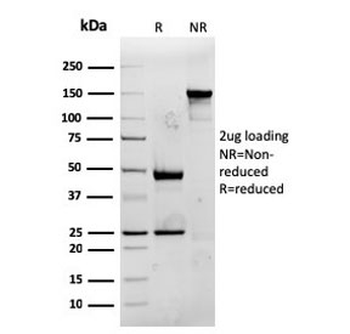 CD74 / CLIP Antibody