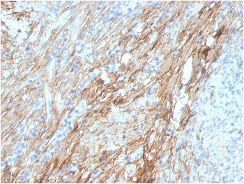 FN1 Antibody / Fibronectin