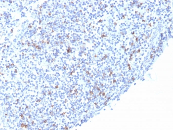 Integrin alpha E Antibody / CD103
