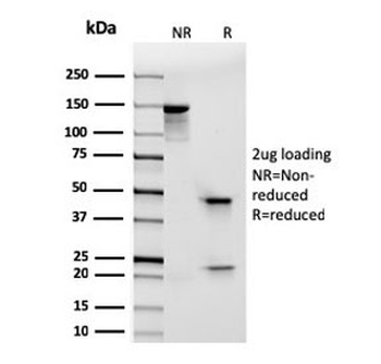 Integrin alpha E Antibody / CD103