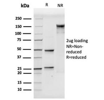 CD106 Antibody / VCAM1