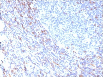ZAP70 Antibody