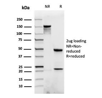 Beta Catenin Antibody