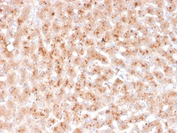 Transthyretin Antibody / TTR / Prealbumin