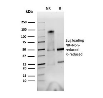 Integrin alpha V + beta 6 Antibody