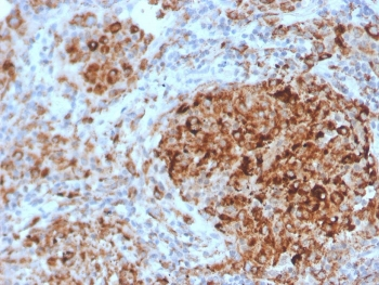 TIM3 Antibody / HAVCR2