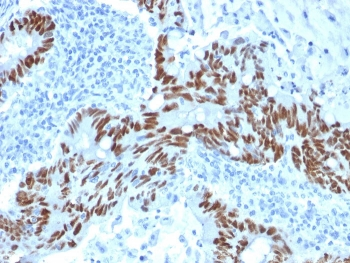 p53 Antibody / TP53