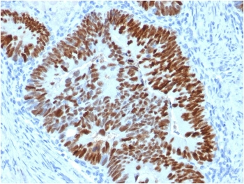 p53 Antibody / TP53