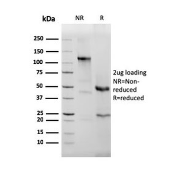 Eosinophil Peroxidase Antibody