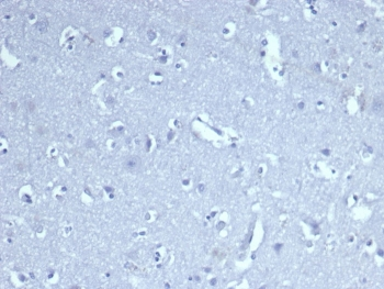 CD8A Antibody