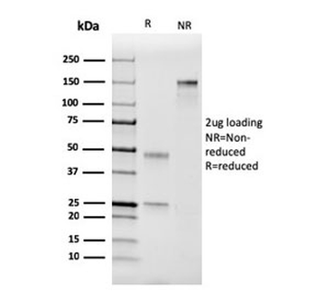 Factor VII Antibody