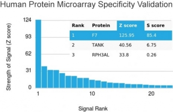 F7 Antibody / Factor VII