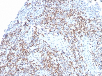 ZAP70 Antibody