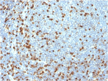 ZAP70 Antibody