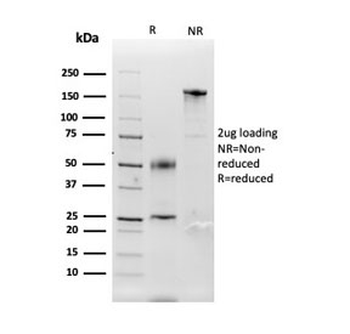 CA9 Antibody / Carbonic Anhydrase IX