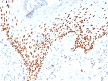 p40 / deltaNp63 Antibody