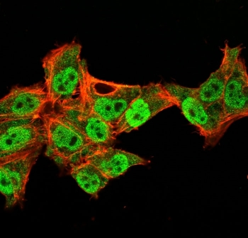 p40 / deltaNp63 Antibody