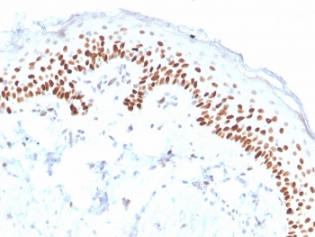 deltaNp63 Antibody / p40