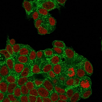 HER2 Antibody / ErbB2 / Extracellular region