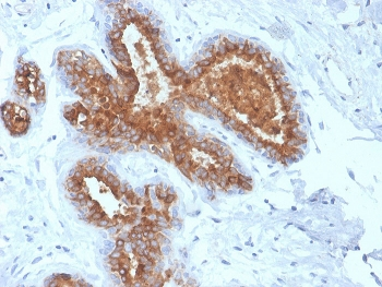 MUC1 Antibody / Mucin-1