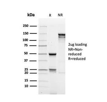 MUC1 Antibody / Mucin-1