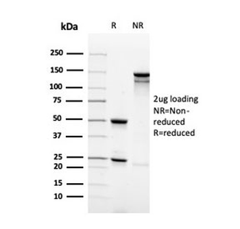Synaptophysin Antibody