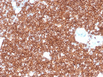 CD4 Antibody